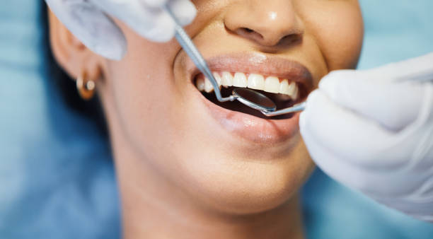 Best Teeth Whitening  in Hildebran, NC
